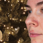 Rosacea hudvård