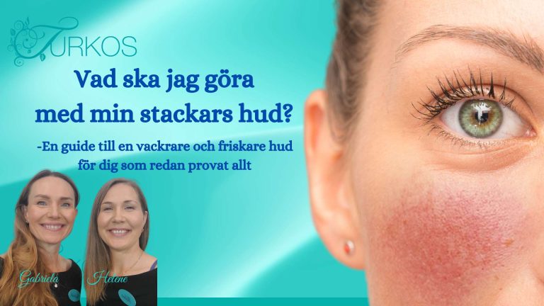 Guide Inflammerad hud - Rosacea